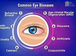 Image result for Common Eye Problems Cream Treatment