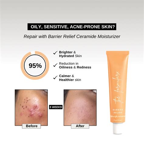 Barrier Relief Lightweight Ceramide Moisturizer - For Oily, Combination ...