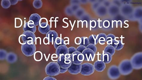 "Die-Off" Symptoms Common in Bacteria, Yeast, Fungal and Parasite- Video #1 | Dr. Hagmeyer