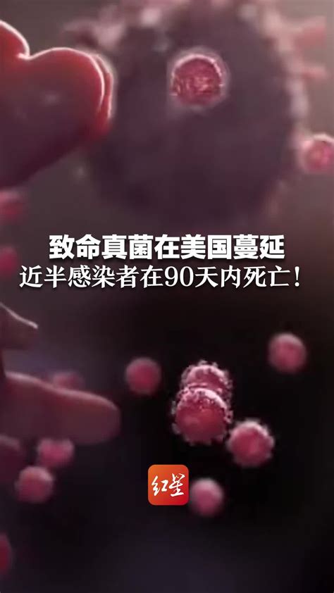 “超级真菌”在美爆发，致死率高达60%，中国已确认18例 - Chinadaily.com.cn