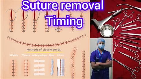 Removing Sutures Step by Step 的图像结果