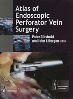 Atlas of Endoscopic Perforator Vein Surgery eBook : Gloviczki, Peter ...