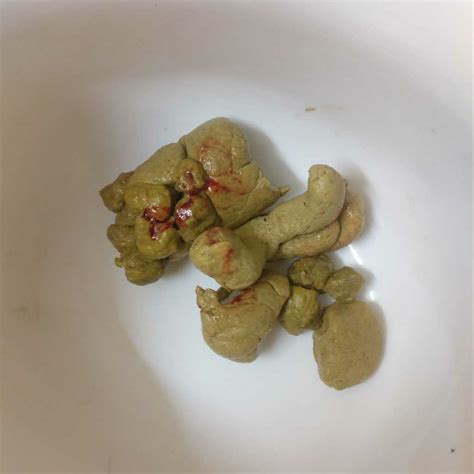 my 4 month baby had a drop of fresh blood in his poop.from birth he is ...