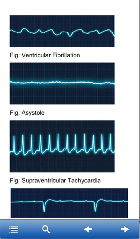 Image result for ACLS Mega Code