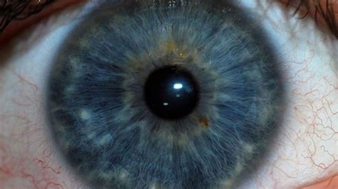 Grandmother's eye wound infested with worms after medication mix-up ...