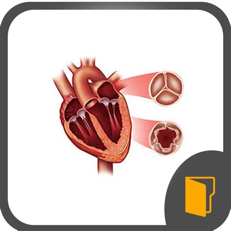 MedXplain