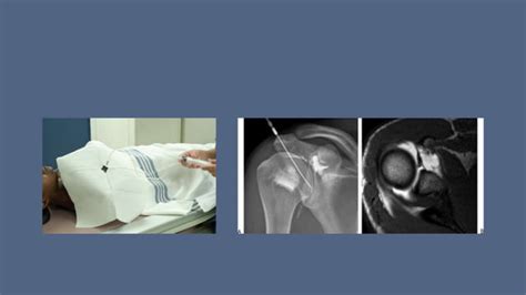 Image result for Arthogram Explained