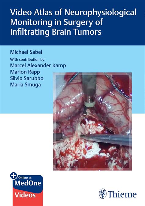 Video Atlas of Neurophysiological Monitoring in Surgery of Infiltrating Brain Tumors: jetzt ...