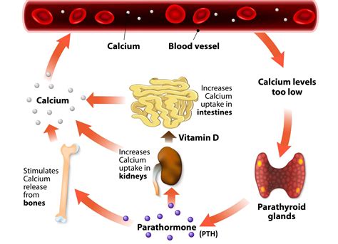 Vitamin D and Primary Hyperparathyroidism - GrassrootsHealth