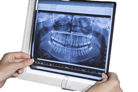 Panoramic Dental X Ray Head Hospital Dentist, Oral, Panoramic, Examination PNG Transparent Image ...