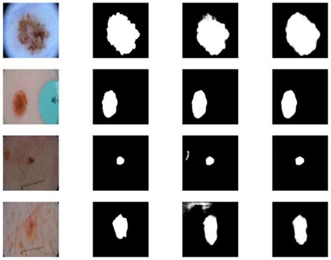 Residual-Attention UNet++: A Nested Residual-Attention U-Net for ...