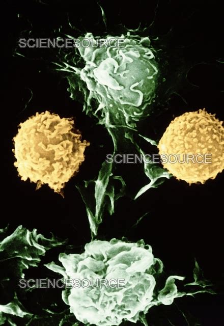 Image result for Lymphocytes Cancer