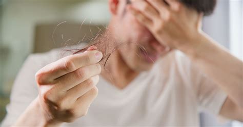 Understanding Stress-Induced Hair Loss and Management Strategies