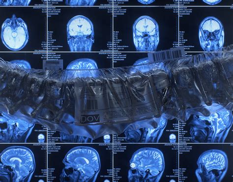 Image result for Spine Effects Tutorial