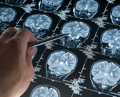 Image result for Muga Scan Lab Results