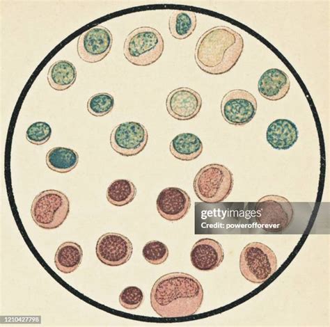 Image result for Monocyte Electron Microscope