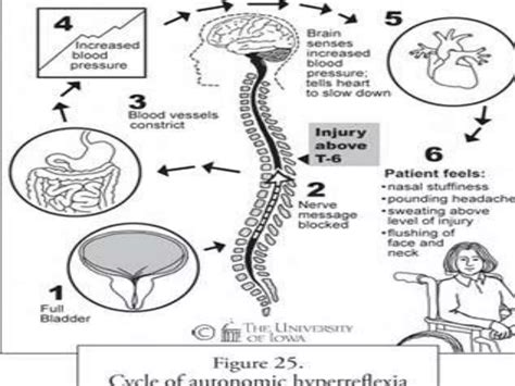 Anesthesia for spinal cord injury and scoliosis030 | PPTX