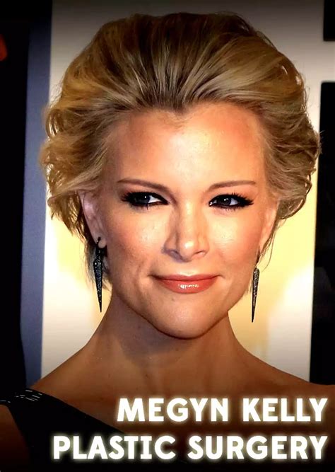 Megyn Kelly Plastic Surgery | Cosmetic Town