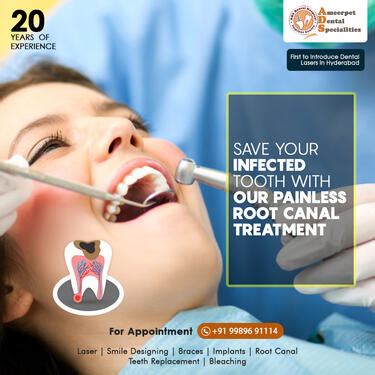Root Canal Treatment And Cost In Hyderabad Painless ADS - Health ...