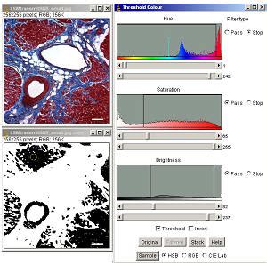 ImageJ Particle Analysis 的图像结果
