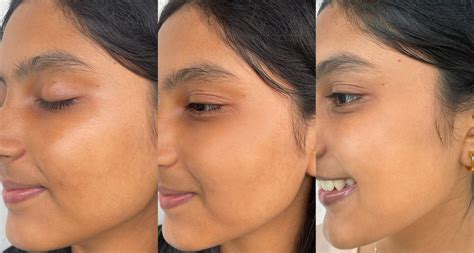 Niacinamide Serum 5% - Matte & Radiant Skin for 8+ Hours – Foxtale