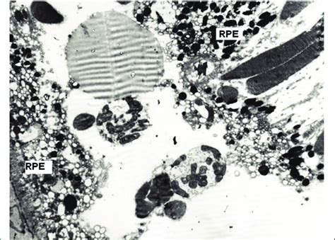 Image result for RPE Hexagonal Structure