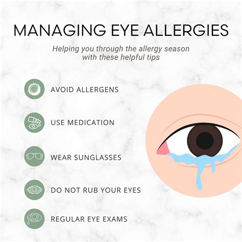 Common Eye Allergies
