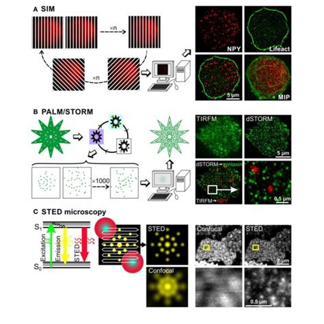 Image result for Super-Resolution Microscopy