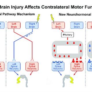 Image result for Contralateral Brain Injury