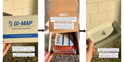 Image result for Sample GI Map