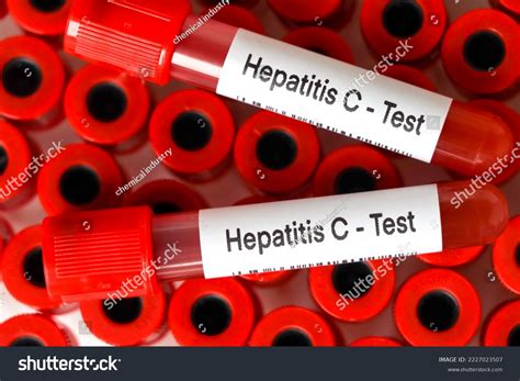 Hep C Test 的图像结果
