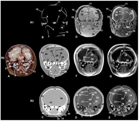 A Study of the Head during Prenatal and Perinatal Development of Two ...