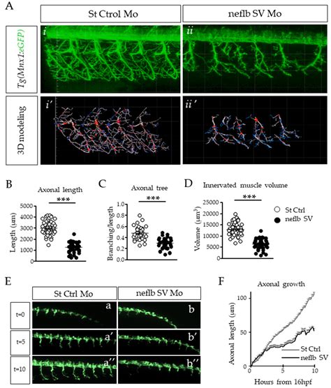 Functional Characterization of Neurofilament Light Splicing and ...