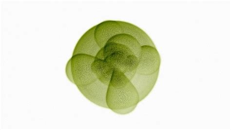 High Chloride Count In Blood Test at Carolyn Pless blog