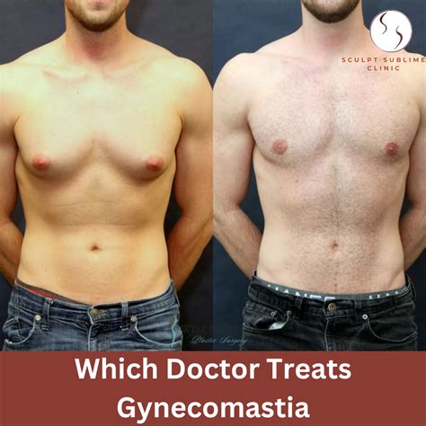 Which Doctor Treats Gynecomastia? Find Out