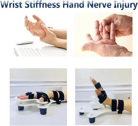 Buy XGJJ Multifunctional Smart Rehabilitation Device for Hand Function ...