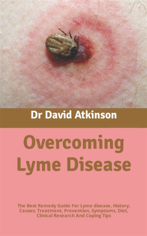 Buy Overcoming Lyme Disease: The Best Remedy Guide For Lyme disease ...
