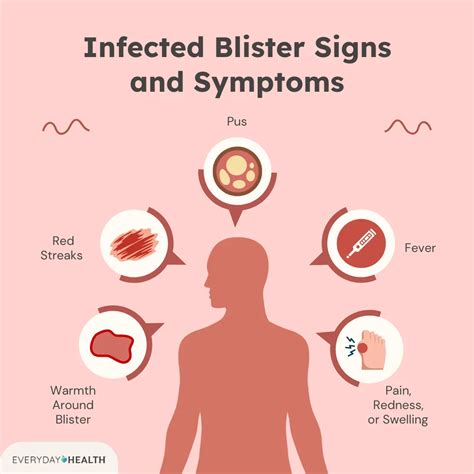 How Do I Know if My Blister Is Infected? Plus, How to Treat It