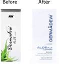 Dermadew Aloe Lotion for skin moisture, 50ml - Pack of 2*50ml - Price ...