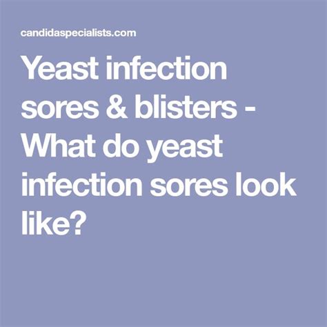 immune system yeast infection