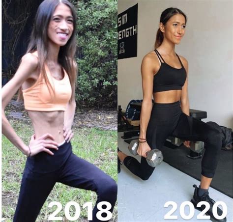 Wie sieht derzeit die junge Frau aus, die vor drei Jahren nur 31 ...