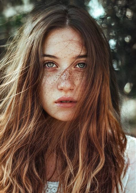Can You Get Rid Of Freckles? Everything Explained!