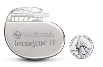 Image result for InterStim System Programs