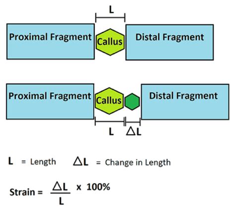 Image result for Feature Writing Structure Example