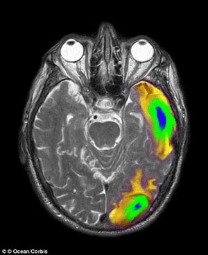 Image result for fMRI Python
