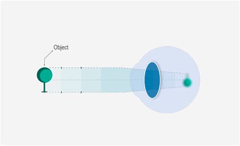 Eyesight problems | Hoya Vision Care