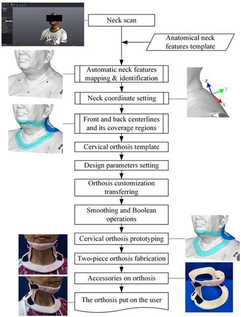 Anatomical-Based Customized Cervical Orthosis Design in Automation