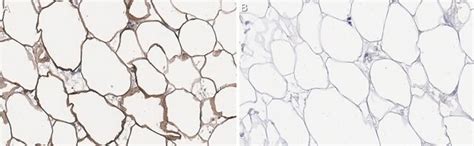 Anti-FASN Antibody, clone 2C13 ZooMAb® Rabbit Monoclonal recombinant ...