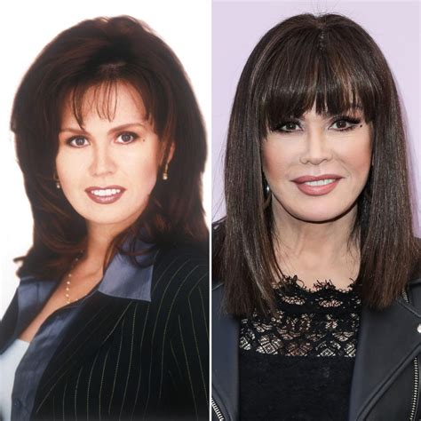 Marie Osmond Before And After