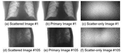 A Deep Learning-Based Scatter Correction of Simulated X-ray Images